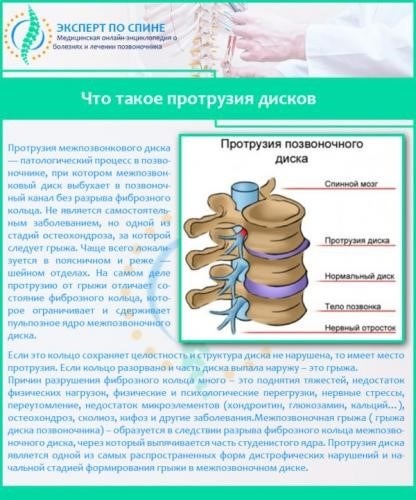 Куда обратиться с сильной болью в спине