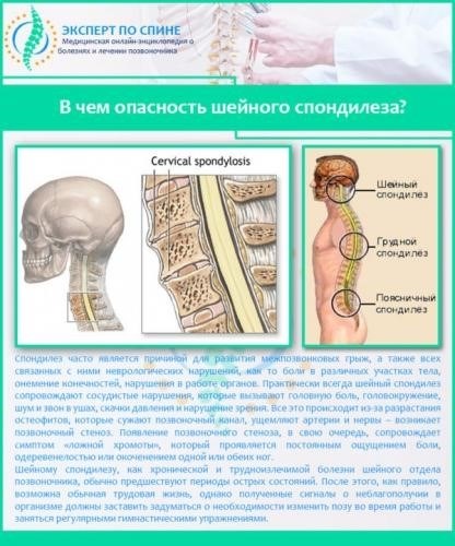 Причины для больничного по причине боли в спине