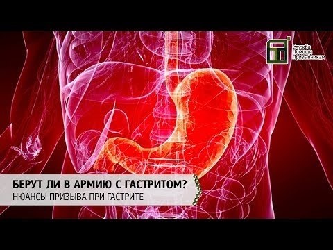 Когда возможно освобождение от службы